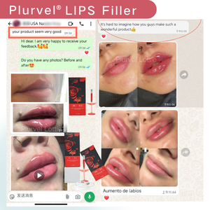 Plurvel - Bon <span class=keywords><strong>prix</strong></span> - Remplisseur de lèvres rouge 1 ml - Remplisseur dermique injectable à l'<span class=keywords><strong>acide</strong></span> <span class=keywords><strong>hyaluronique</strong></span> pour modeler les lèvres naturellement - Améliore la couleur des lèvres - Product Image 6