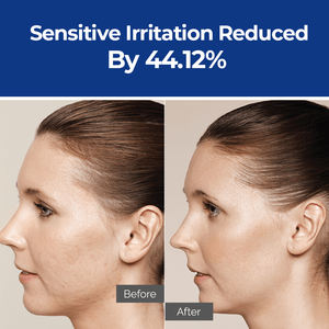 Private Label blu rame Peptide prodotti per la cura della pelle Anti invecchiamento rughe ridurre le linee sottili Lifting siero viso per la cura del viso - Product Image 5