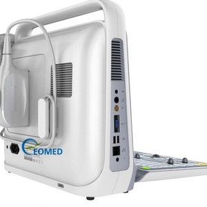 Portable Human Veterinary Ultrasound <b>Scanner</b> with Color Doppler Multi-Frequency Probe for Comprehensive Diagnostic CU60-1 - Product Image 3