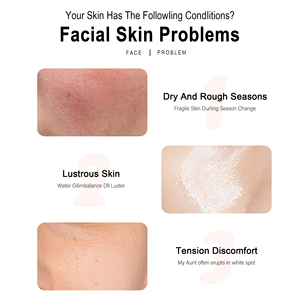 ชุดผลิตภัณฑ์ดูแลผิวจากเกาหลีชุดผลิตภัณฑ์ดูแลผิวที่ช่วยให้ผิวขาวกระจ่างใสสำหรับผิวแห้ง - Product Image 5