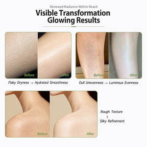 Conditionneur Hydra-Restore à la Biotine & Beurre de Karité - Répare les cheveux secs et abîmés, prévient les pointes fourchues - Product Image 5