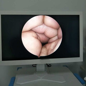 Sistema de câmera Professinal médico CMOS Endoscopia HD/4K Set/Endoscopy Tower - Product Image 4