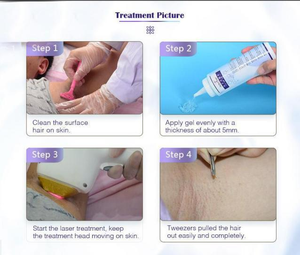 Appareil laser diode de bureau 808 nm pour l'épilation, avec longueurs d'onde 755, 1064 et 940 nm, pour clinique esthétique - Product Image 4