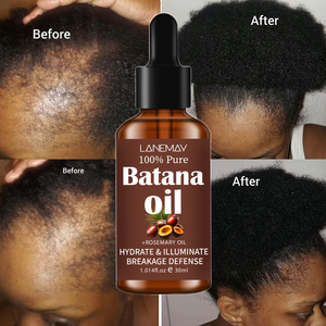 Olio di Rosmarino 100% Puro Naturale e Biologico, Olio Essenziale Avanzato, Olio di Batana per la Crescita dei Capelli e la Cura della Pelle - Product Image 1