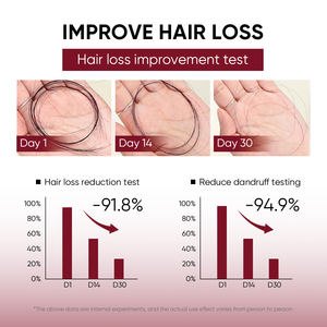 แชมพูและครีมนวดผมที่ช่วยให้ผมร่วงปราศจากซัลเฟตสินค้าตรา OEM - Product Image 3