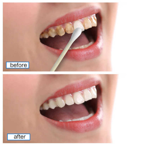 Sérum blanchissant naturel pour les dents EFERO, élimination des taches de café et de thé, nettoyage en profondeur - Product Image 2