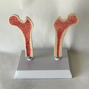 Gran Venta de patología de la osteoporosis y modelo de enseñanza de densidad ósea saludable para estudiar - Product Image 3