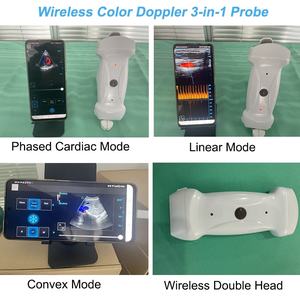 उच्च गुणवत्ता वाले पोर्टेबल अल्ट्रासाउंड डिजिटल वायरलेस हैंडहेल्ड अल्ट्रासाउंड मशीन डॉक्टर के उपयोग के लिए - Product Image 4