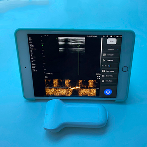 Sonda de ultrasonido inalámbrica para Android, portátil, USB y <span class=keywords><strong>WIFI</strong></span>, a Color - Product Image 4