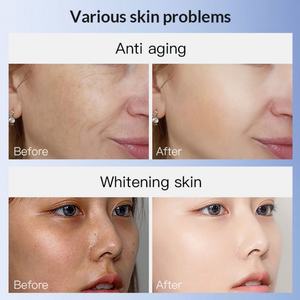 Freckle Removal Reduce Fine Lines Facial Moisturizing Whitening Woman Anti Aging Niacinamide Brightening <b>Skin</b> <b>Care</b> <b>Set</b> - Product Image 2