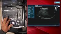 Mindray-Sonda multifrecuencia de ultrasonido para uso veterinario, peso ligero, B/W, precios baratos de fábrica, de mano