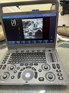 Ecógrafo Portátil Sonoscape E2V de Buena Calidad y Ecógrafo Doppler Color para Uso Veterinario con la Mejor Calidad y Precio Bajo - Product Image 3