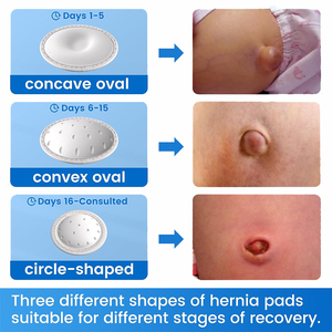 Faja Abdominal para Hernia Umbilical en Bebés Recién Nacidos, Niños Pequeños y Niños, Soporte para Hernia Umbilical - Product Image 3