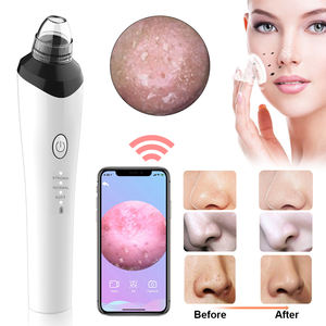 Aparelho de limpeza de poros, kit para limpeza de poros por sucção, removedor de cravo, câmera a vácuo - Product Image 2