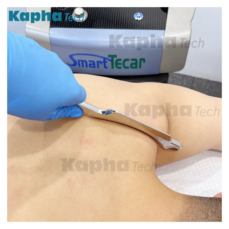 뜨거운 판매 Kapha 스마트 Tecar 프로 치료 물리 치료 Rf 통증 완화 기계