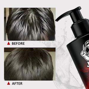 Champú Personalizado para Mujer OEM ODM 296ml con Ácido Glicérico y Extracto de Árbol de Té Anticaspa, Antipicazón, Hidratante, Control de Grasa y Anti-Frizz - Product Image 1