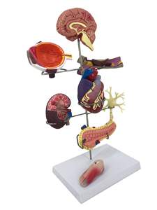Model Patologi <span class=keywords><strong>Diabetes</strong></span> Manusia 8 Bagian untuk Pengajaran - Product Image 1