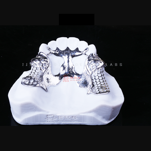 Marco metálico completo <span class=keywords><strong>superior</strong></span> e inferior con <span class=keywords><strong>dentadura</strong></span> <span class=keywords><strong>parcial</strong></span> acrílica - Product Image 3