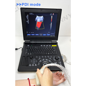 Veteriner kullanımı için SY-A020E fabrika fiyat dizüstü renkli <span class=keywords><strong>doppler</strong></span> 3D ultrason tarayıcı - Product Image 4