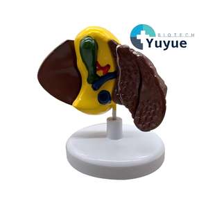 แบบจำลองการสอนเกี่ยวกับมะเร็งตับพร้อมฐาน - เครื่องมือกายวิภาคที่ถอดออกได้สำหรับการศึกษาโรคตับ - Product Image 1