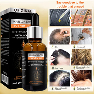 Olio <span class=keywords><strong>per</strong></span> la Crescita dei <span class=keywords><strong>Capelli</strong></span> con Formula Naturale, Etichetta Privata Personalizzata, Siero Nutriente <span class=keywords><strong>per</strong></span> il Cuoio Capelluto, Olio Organico <span class=keywords><strong>per</strong></span> Rapido Infoltimento dei <span class=keywords><strong>Capelli</strong></span> - Product Image 4