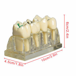 Modelo de Sellador de Fisuras Dentales Transparente para Niños, para la Prevención de Caries, Procedimiento de Obturación Dental, Accesorio de Equipo de Terapia Oral - Product Image 4