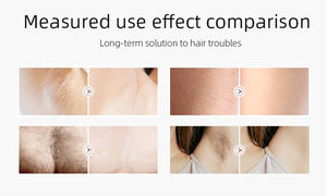 Ev için diyot lazer kalıcı ağrısız epilasyon makinesi Mini 3 dalga boyu 808nm nm 808nm 1064nm taşınabilir 2000W 11mm * 11mm - Product Image 3