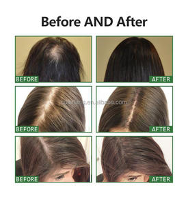 Private Label vendita calda succsione naturale Batana olio essenziale per capelli organico Anti perdita di capelli per gli uomini e le donne di uso - Product Image 6