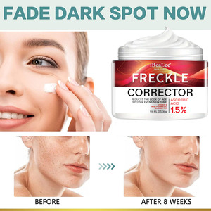 Crema Blanqueadora para Pecas, Eliminador de <span class=keywords><strong>Manchas</strong></span> Oscuras y Melasma, Anti-<span class=keywords><strong>Manchas</strong></span> Marrones, Aclara la Pigmentación, Hidratante, Cuidado de la Piel, Productos Coreanos - Product Image 5