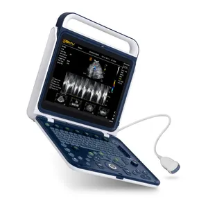 Taşınabilir dizüstü ultrason 4D ultrason makinesi tam dijital ultrason tarayıcı