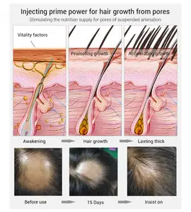 1 galão de óleo de coco óleo de cabelo para o crescimento do cabelo crescimento soro tratamento do crescimento do cabelo do couro cabeludo natural óleo mais rápido