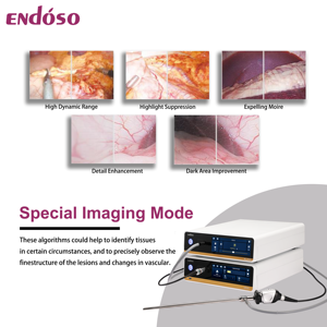 Endoso UHD Laparoscopy Hysteroscopy ENT Imaging System <strong>Auto</strong> <strong>Focusing</strong> 4K Medica Endoscopy Camera System - Product Image 6