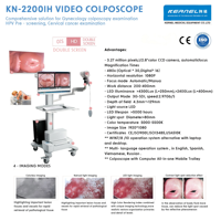 Diagnostic Instrument Kernel Full HD Digital Video Colposcope for Accurate Gynecological Examinations and Cervical Screening