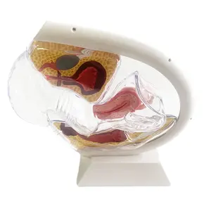 New design female reproductive system model Transparent uterus model Female anatomical model