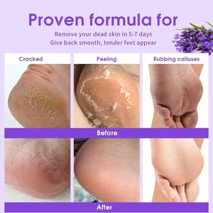 Masque exfoliant pour les pieds à la lavande, marque privée, en gros, pour éliminer les peaux mortes et les callosités, lissant et soignant les pieds - Product Image 4