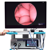 Sistema de cámara de endoscopia UHD Ultra HD profesional de gama alta, cámara endoscópica médica para cirugía veterinaria,