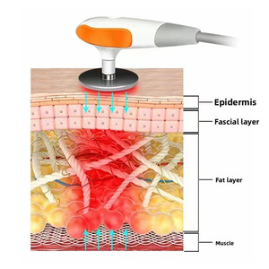 Nuevo Equipo de Belleza con Radiofrecuencia Monopolar de 448k para Fisioterapia por <span class=keywords><strong>Diatermia</strong></span>, Reafirmación de la Piel y Moldeamiento Corporal - Product Image 3