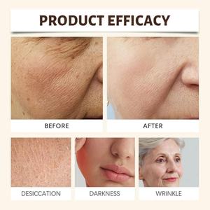 Crema Facial Personalizada OEM con Logotipo Privado, Bálsamo Hidratante de Sebo para el Cuidado de la Piel, para Todo Tipo de Piel, con Ingredientes de Niacinamida y Aceite de Oliva - Product Image 6