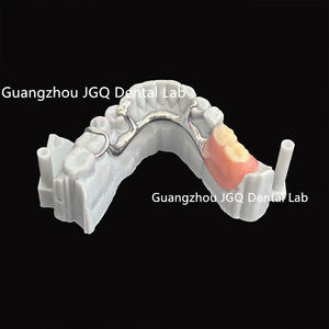 Prothèses dentaires amovibles avec cadre métallique imprimé <span class=keywords><strong>en</strong></span> 3D par laser, fabriquées <span class=keywords><strong>en</strong></span> Chine, laboratoire dentaire, <span class=keywords><strong>prix</strong></span> d'usine - Product Image 2