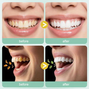 UUKKG <span class=keywords><strong>Bain</strong></span> <span class=keywords><strong>de</strong></span> <span class=keywords><strong>bouche</strong></span> aux fruits, nettoyant buccal, approuvé pour les taches et la plaque dentaire, pour appareils dentaires et prothèses, saveur menthe - Product Image 3