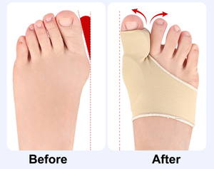 1 Paar <span class=keywords><strong>Bunion</strong></span> Corrector Gel Siliconen Hallux Valgus Orthetica Voeten Sokken Grote Teen Beschermer Guard <span class=keywords><strong>Bunion</strong></span> Corrector - Product Image 3