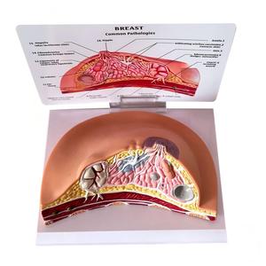 Tıbbi Öğretim İçin Yaygın Patolojileri İçeren İnsan Meme Anatomisi Modeli - Product Image 2