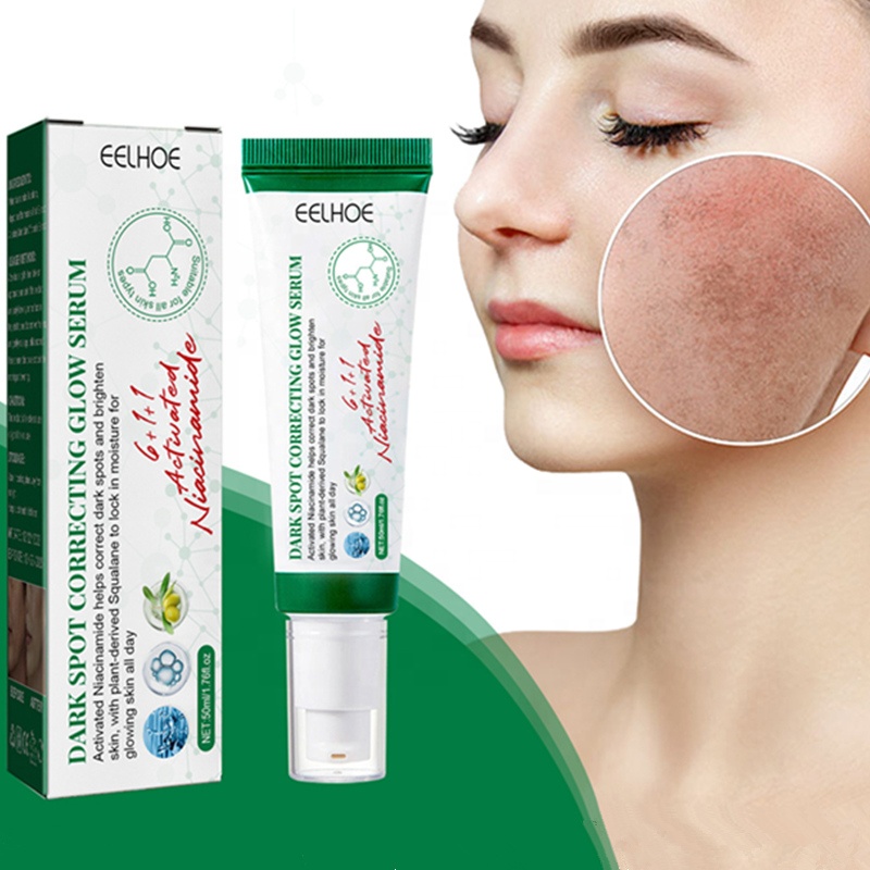 EELHOE corrector de manchas oscuras marrón edad avanzada eliminación de manchas productos para el cuidado de la piel para la corrección de manchas oscuras suero de brillo 50ml