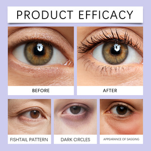<span class=keywords><strong>Crema</strong></span> para Ojos de Marca Privada con Logotipo Personalizado, <span class=keywords><strong>Hidratante</strong></span> de Larga Duración, Iluminadora y Blanqueadora para Piel Opaca y Eliminación de Ojeras - Product Image 4
