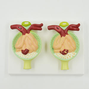 चिकित्सा शिक्षण उपकरण का विस्तार मानव प्रोटीनुरिया मॉडल गुर्दे मूत्र प्रोटीन पैथोलॉजिकल संरचना मॉडल - Product Image 2