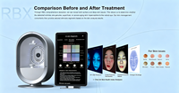 Système publicitaire IA prenant en charge 19 langues, analyseur facial professionnel de la peau, analyseur de peau, scanner 3D, appareil avec écran 21,5 pouces