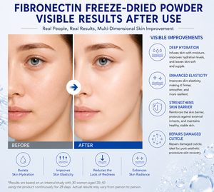 Hot Selling Laminin Freeze-Dried <b>Powder</b> for Skin Rejuvenation and Anti-Aging Peptides OEM Raw Material Lyophilized <b>Powder</b> - Product Image 4