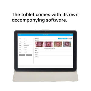 Colposcopio Digital HD Sunbright S-10U para Examen Ginecológico, Colposcopio Vaginal Portátil - Product Image 5