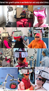 Máquina de Tricosología Láser de Bajo Nivel, 424 Láseres, 650nm, LLLT, Modelo Kernel 8000A para el Tratamiento de <span class=keywords><strong>la</strong></span> <span class=keywords><strong>Alopecia</strong></span> Androgenética - Product Image 6