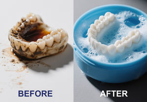 Nettoyant professionnel pour appareils orthodontiques en gros - 60 comprimés - Sans danger pour tous les aligneurs, protège-dents et protège-dents nocturnes - Product Image 3